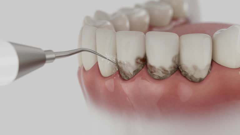 Reliable Dental Implants contractor in Penrose, CO by Smile Center Dentistry
